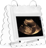 Mlatnod flip ultrasound photo album with stand front view showcasing acrylic scalloped cover on tabletop
