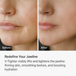 Rejuran c-PDRN skin tightening mask sheets