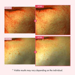 Korean skincare glass skin serum for uneven skin tone correction.