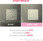 Before and after results of Aprilskin pore tightening mask treatment.