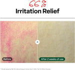 Dr. G Red Blemish Clear Soothing Toner bottle side profile