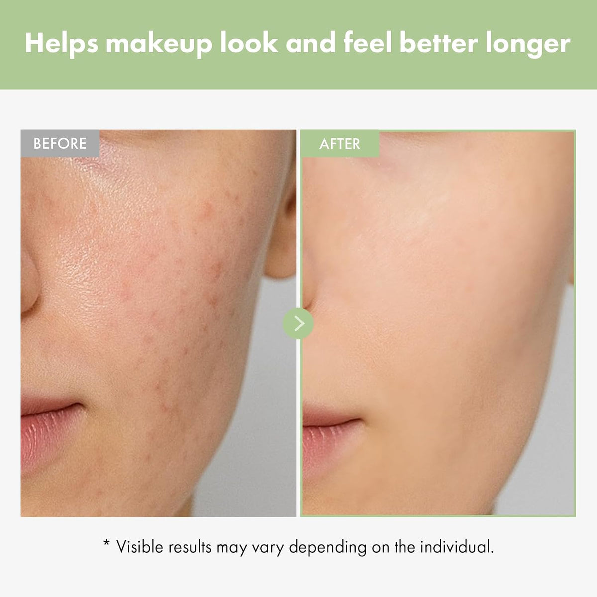 TOSOWOONG Real Collagen Face Cream texture displaying the rich hydrolyzed collagen wrapping formula.