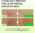 Eqqualberry Aloe Pdrn Calming Toner packaging details and size