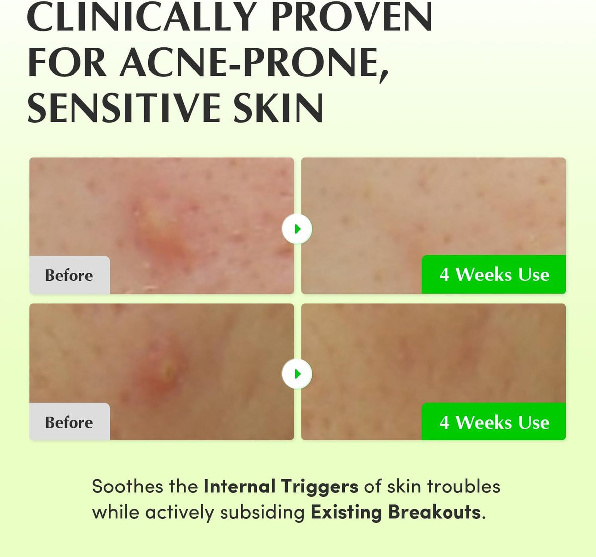 Eqqualberry Aloe Pdrn Calming Toner packaging details and size