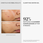 Murad Clarifying Water Gel - Lightweight Face Moisturizer for Acne-Prone Skin with Salicylic and Hyaluronic Acid for Breakout Prevention, Hydration, and Shine-Free Finish - 2 Fl Oz - Image 2