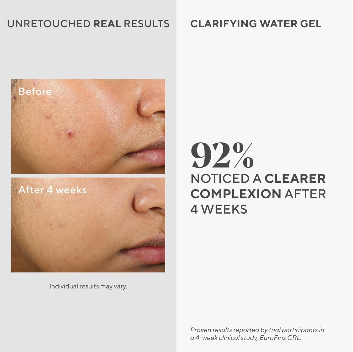 Murad Clarifying Water Gel - Lightweight Face Moisturizer for Acne-Prone Skin with Salicylic and Hyaluronic Acid for Breakout Prevention, Hydration, and Shine-Free Finish - 2 Fl Oz - Image 2