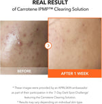 The dual tubes of the APRILSKIN Carrotene Clearing Solution arranged with the five sheet masks demonstrating full kit contents.