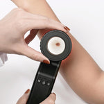 Iboolo DE-4100 Pro dermatoscope attached with magnetic smartphone kit for clinical photography