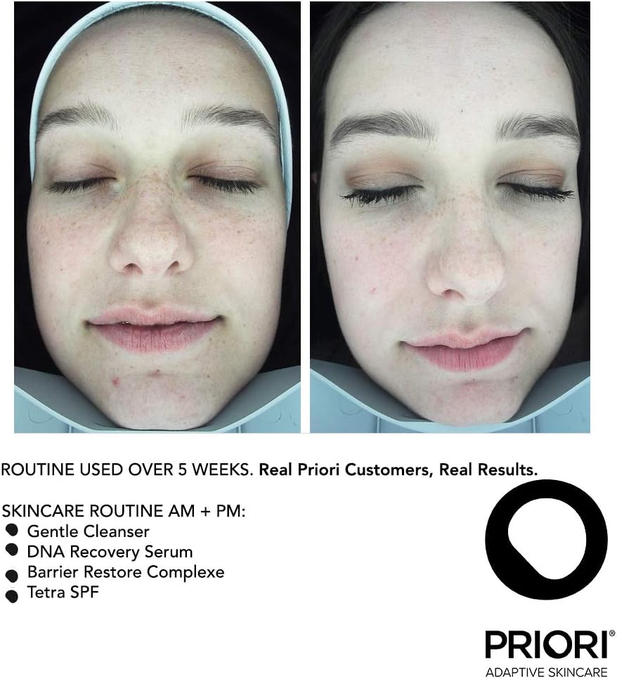 Priori DNA Fx221 Recovery Serum applied on face and neck