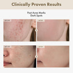 Tosowoong K-beauty brightening serum dropper bottle showcasing glass skin formulation