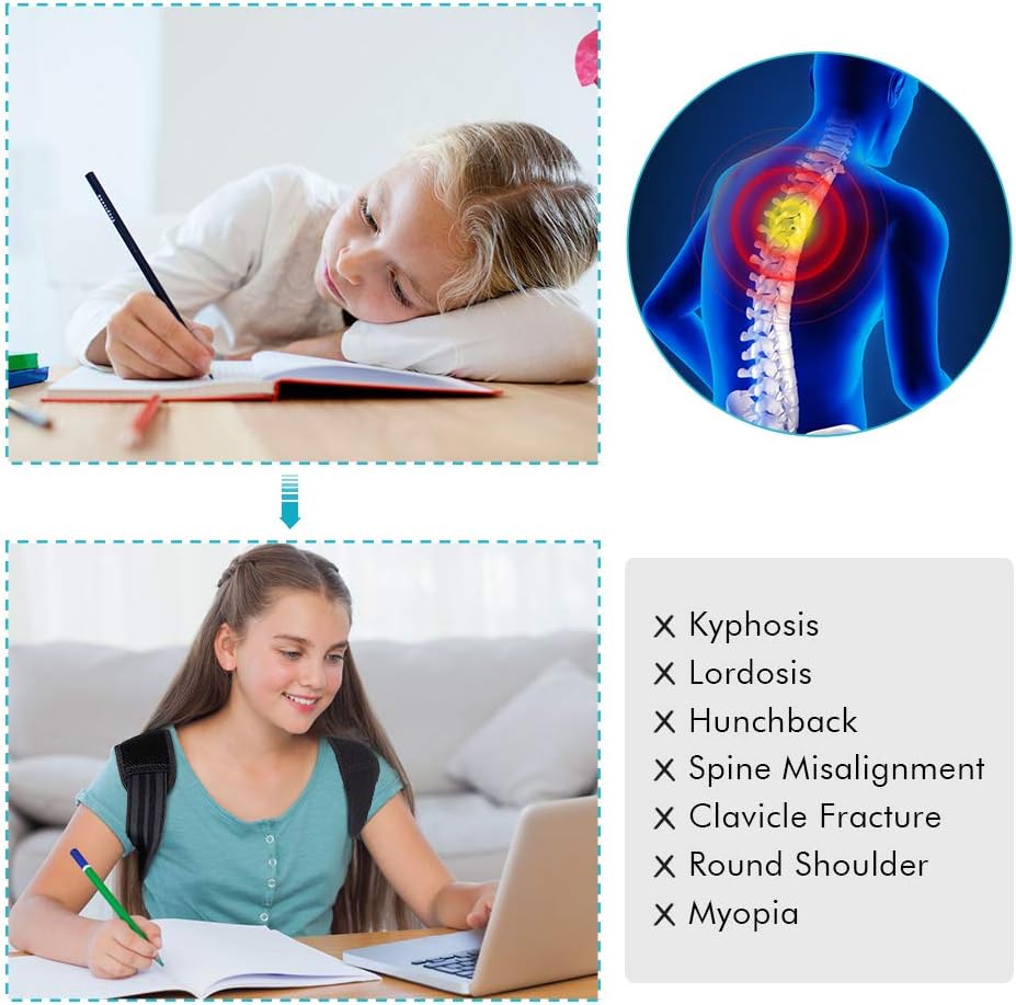 Posture Corrector for Teens, Upper Back Posture Brace for Teenagers Under Clothes Spinal Support to Improve Slouch, Prevent Humpback Relieve Back Pain, Adult Woman Teenage Girl Back Posture Corrector - Image 5