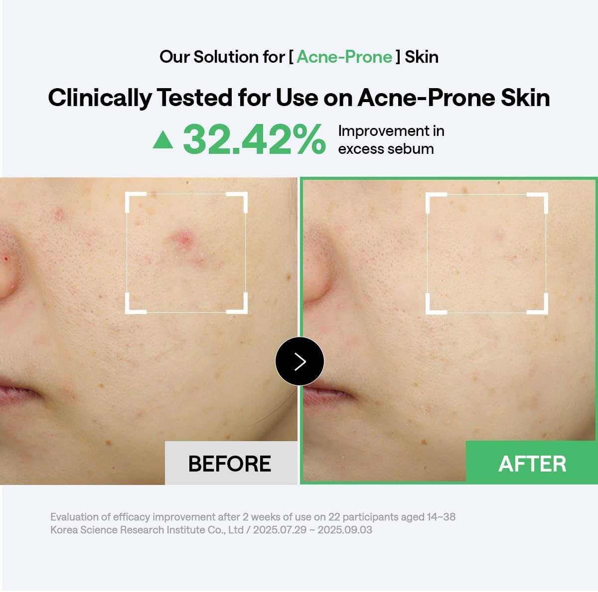 Mediheal square cotton gauze pads pre soaked in tea tree serum