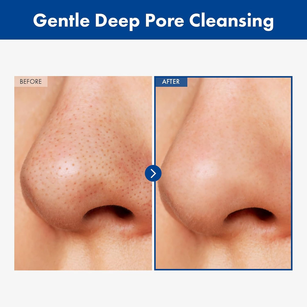 Tosowoong Korean skincare pore cleanser packaging with jojoba oil