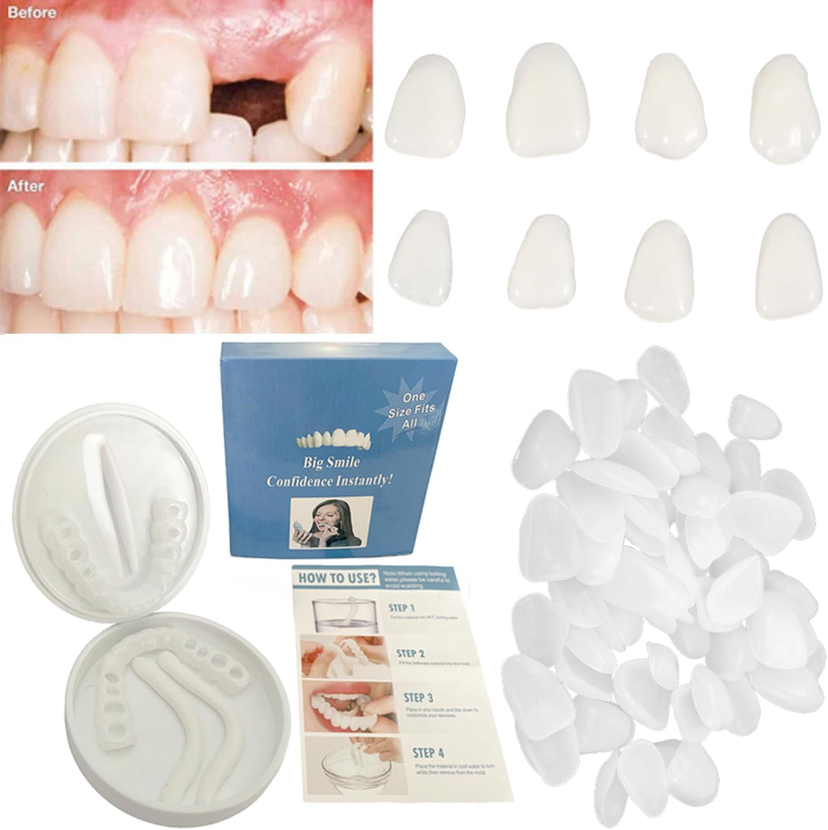 Womcare Fake Tooth Repair Kit front view packaging