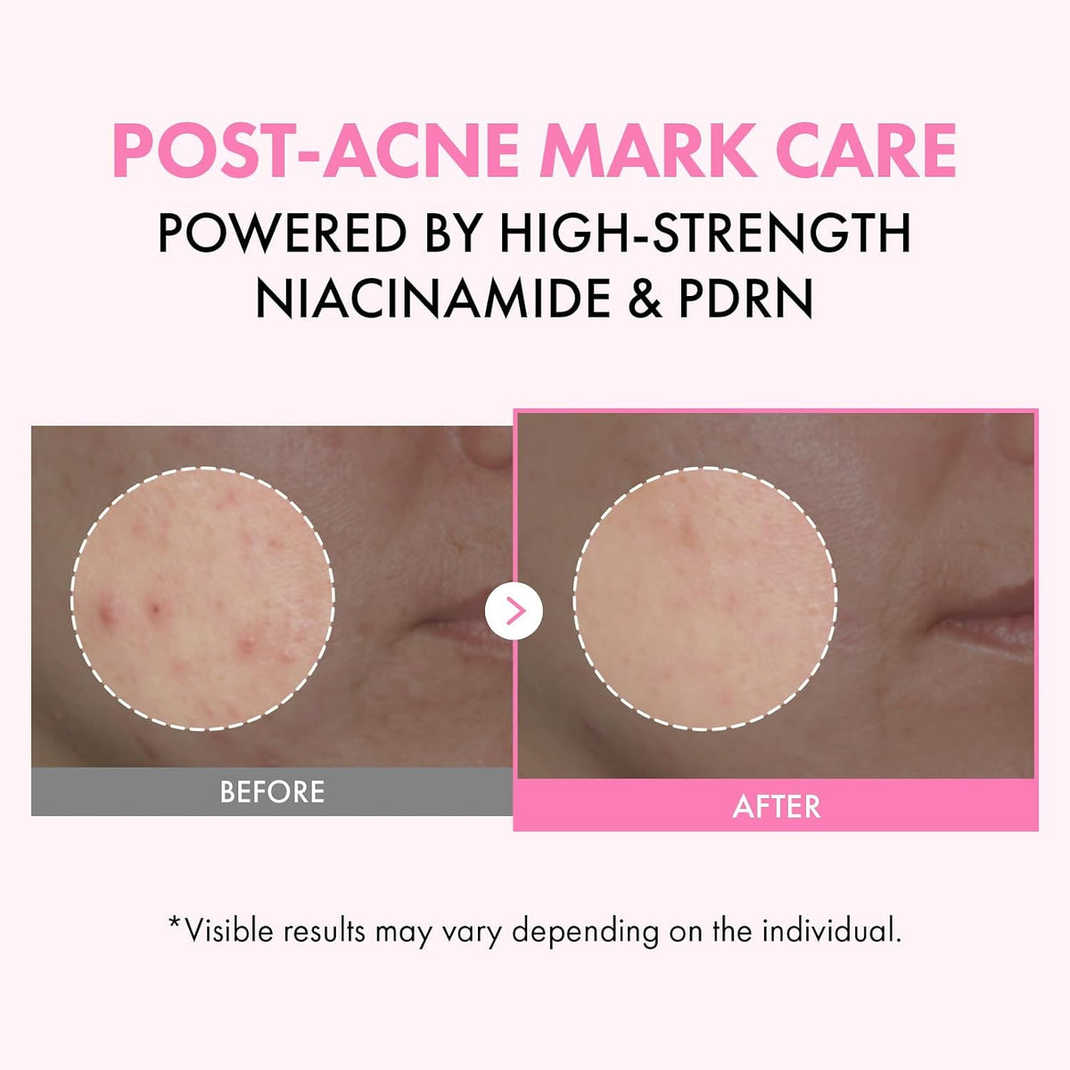 Authentic Tosowoong Korean milky toner with salmon DNA showing packaging details.