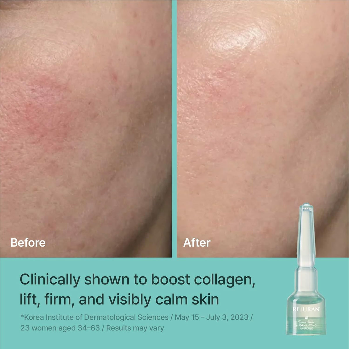 Rejuran Korea skincare clinical lifting serum set