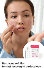 DERMALOGY by NEOGENLAB A-CLEAR SOOTHING ACNE CARE (1 PACK) - Image 3