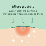 Rael Korean skincare microcrystal patch for deep underground blemish control