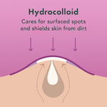 Model applying a Rael hydrocolloid pimple patch onto a facial blemish before bed