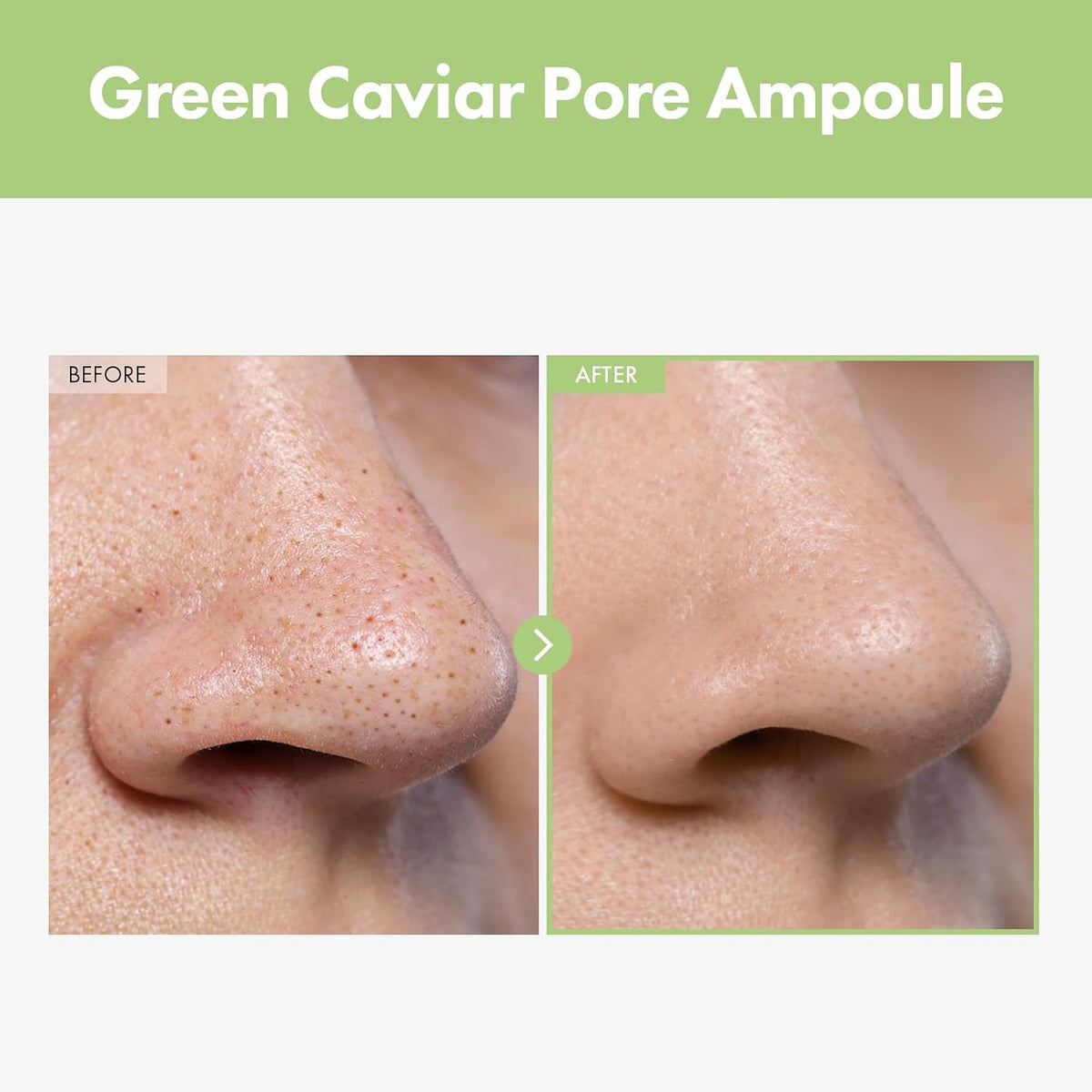 TOSOWOONG oil-control face moisturizer being applied to the T-zone area for a matte finish.
