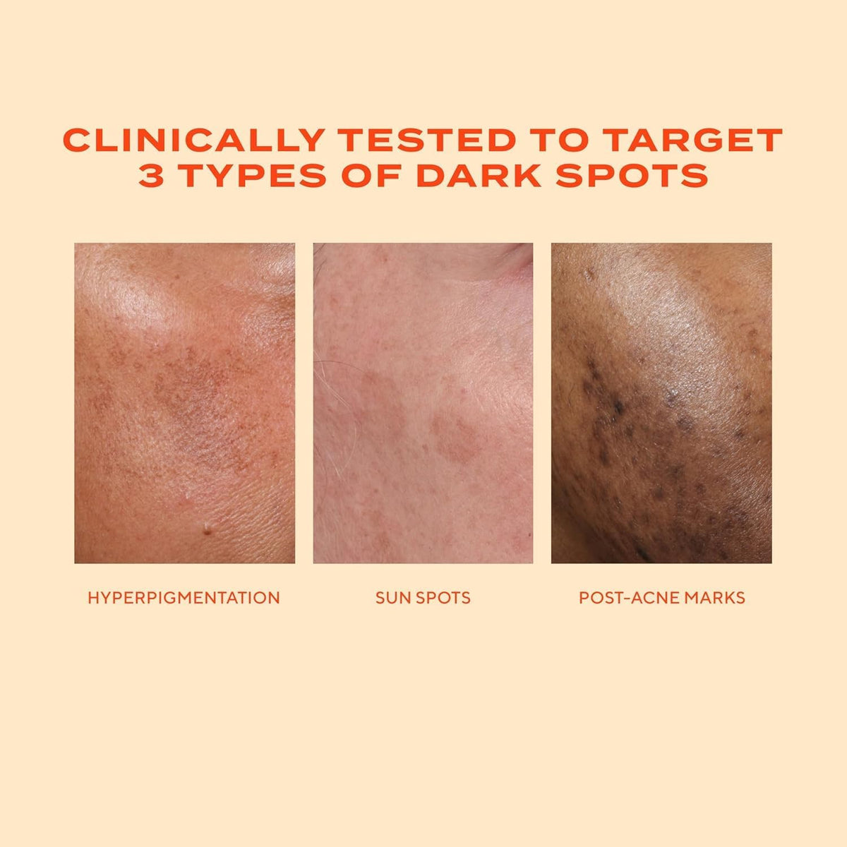 Murad clinical facial serum duo for dark spot reduction and under-eye renewal treatment