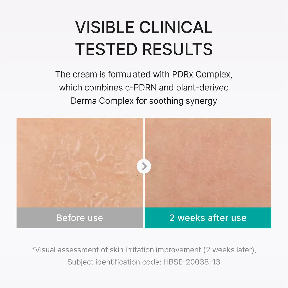 Texture swatch of Rejuran daily moisturizer