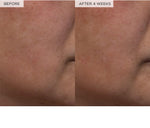 Skincare routine application of Glow Recipe Watermelon Toner