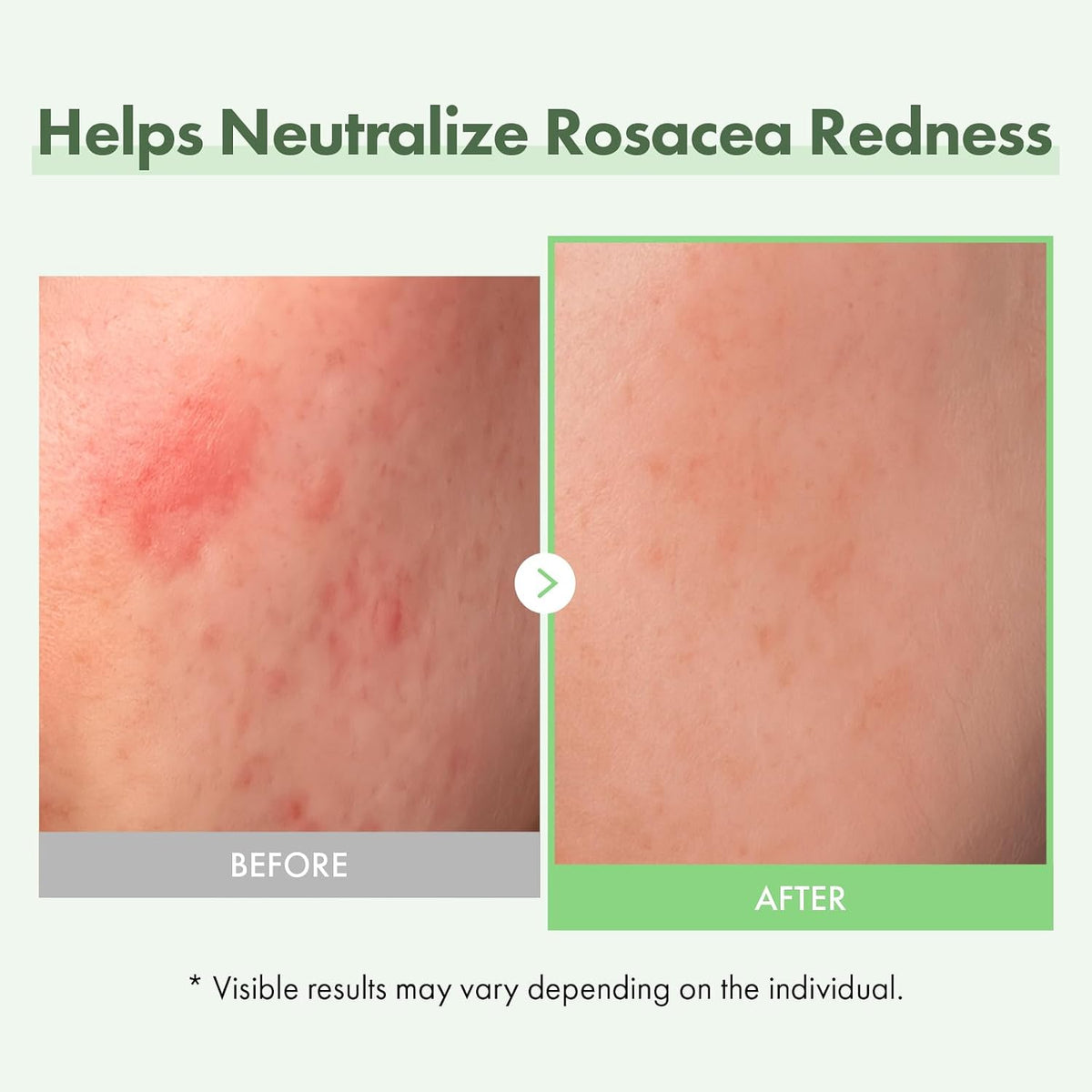 Authentic TOSOWOONG sensitive skin serum with niacinamide and centella asiatica packaging