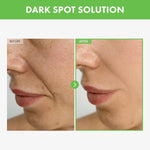 TOSOWOONG Korean skincare blemish cream for fading hyperpigmentation packaging