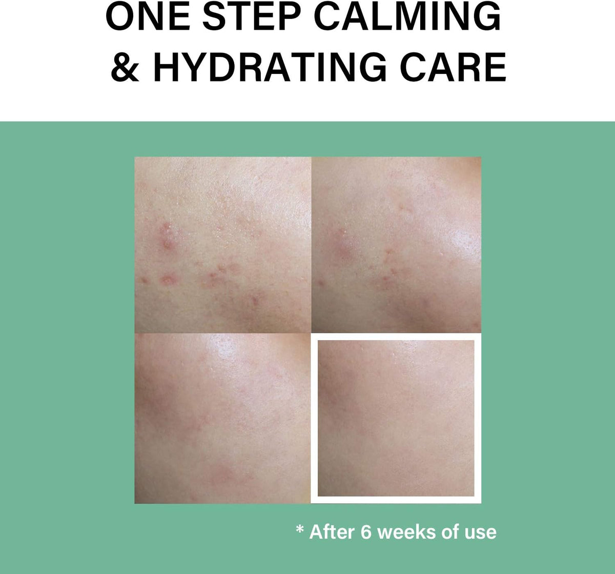 Celimax triple hyaluronic acid hydrating ampoule for redness relief