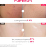 Aprilskin Korean skincare overnight face mask applied seamlessly to facial contours.