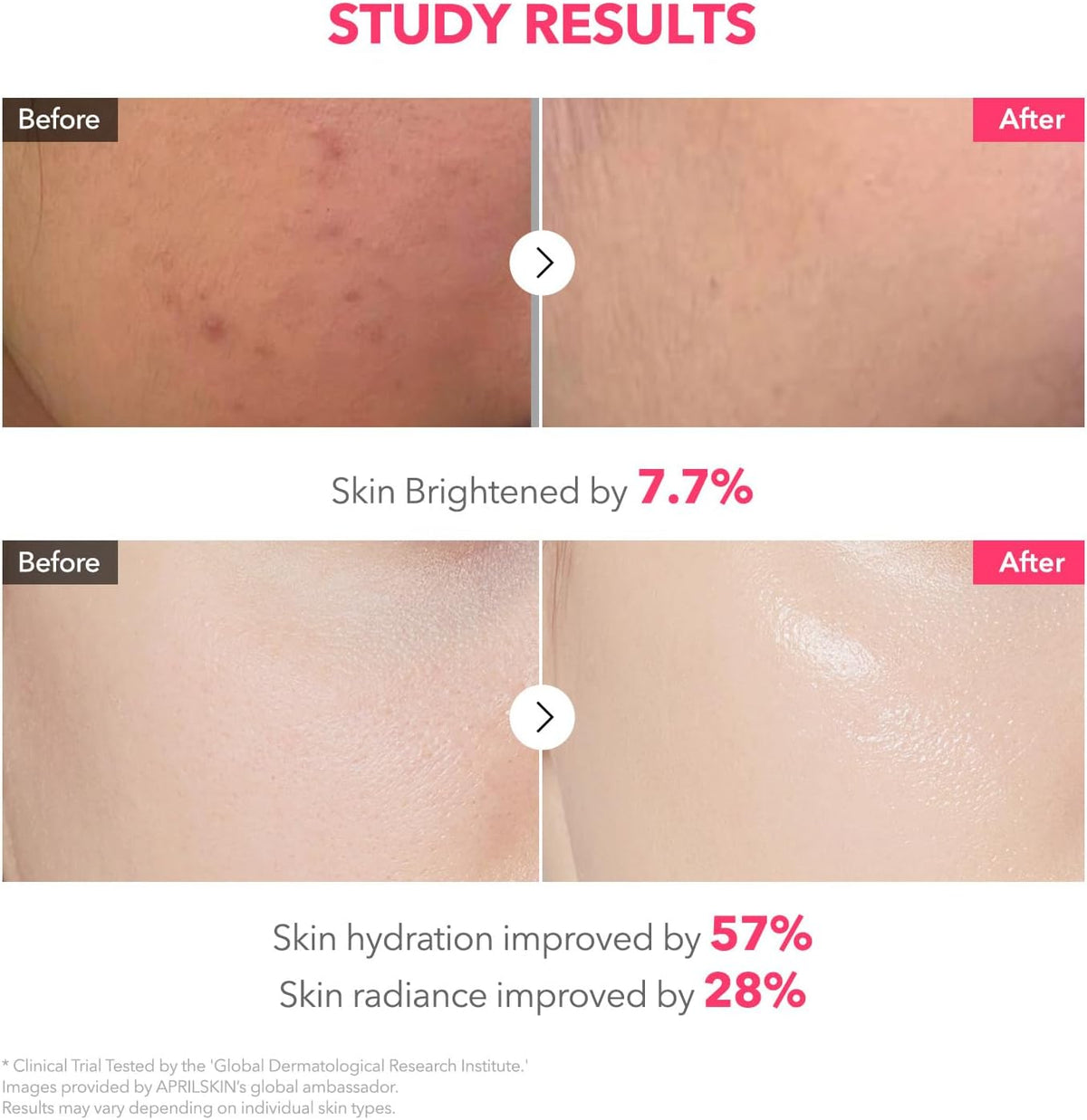 Aprilskin Korean skincare overnight face mask applied seamlessly to facial contours.