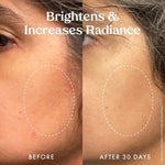 Dropper dispensing Kopari Star Bright brightening serum onto fingertips