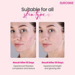 Suroskie Rose Instant Enzyme Face Scrub full set packaging view