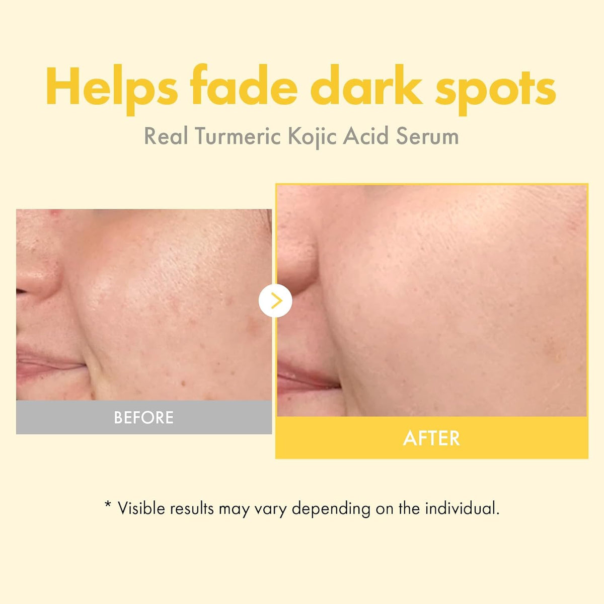 TOSOWOONG Radiance Boosting & Hydrating Serum Bundle - Real Turmeric Kojic Acid Serum for Dark Spots + Hyaluronic Acid 3% Serum for Deep Moisture - K-Beauty Glow Skin Set with Glycolic Acid, Alpha Arb - Image 9