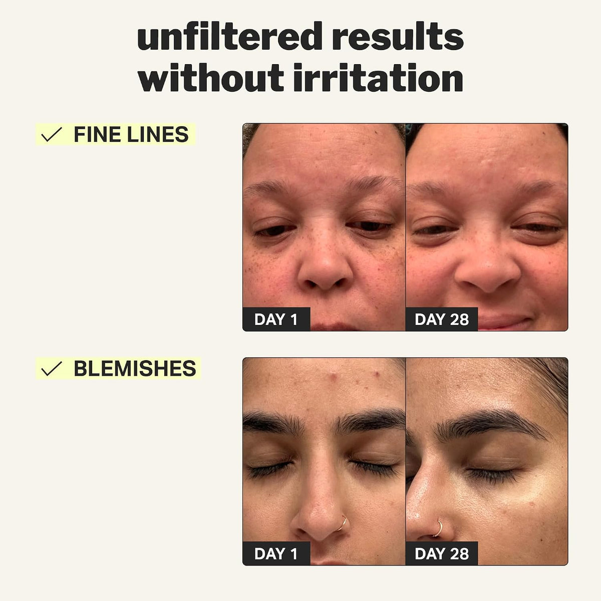Cocokind Retinol Face & Body Renewal Bundle - Beginner Retinol Gel 0.1% + Retinol Body Cream, Improves Fine Lines, Uneven Texture & Tone, Hydrating, Sensitive Skin Friendly - Image 9
