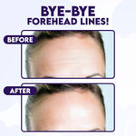 Bloomora hydrogel anti wrinkle patches individual packet layout