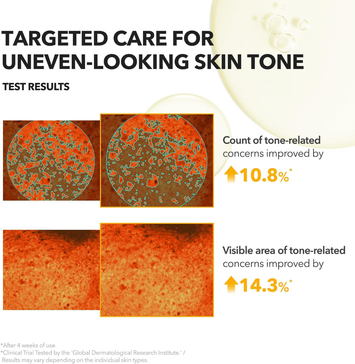 Aprilskin full body brightening care serum application on arms and legs