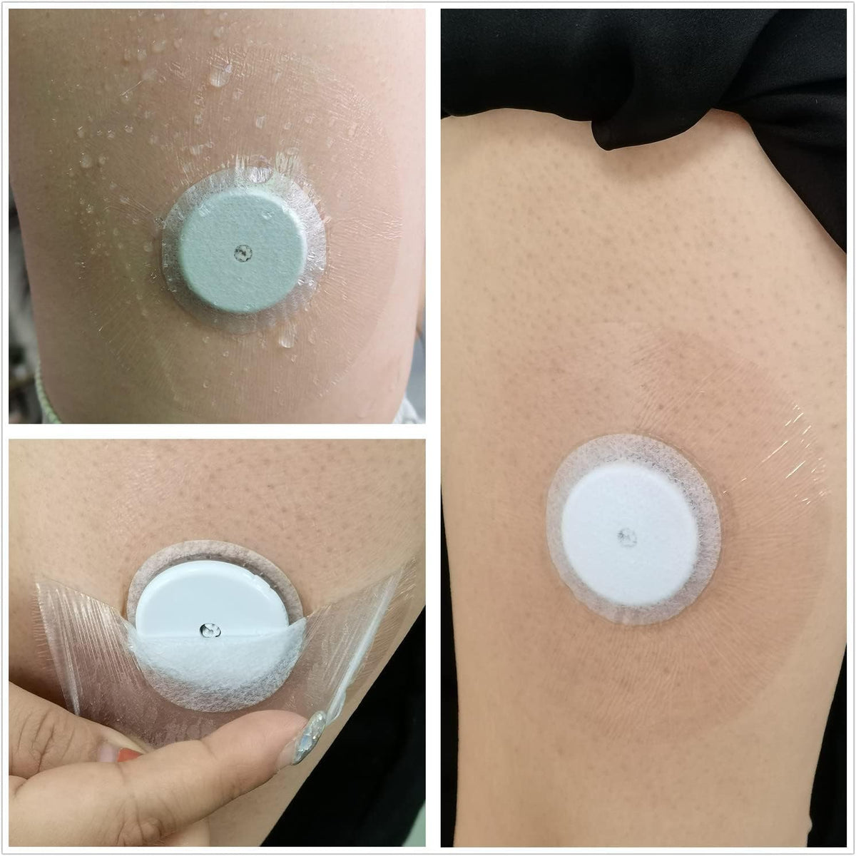 Transparent cgm waterproof patch applied on arm