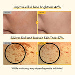 Authentic TOSOWOONG hyperpigmentation cream imported to India for even skin tone