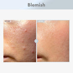 Tosowoong Arbutin 7 Tranexamic Acid 4 Cream tube for hyperpigmentation treatment