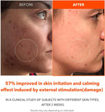 Back label of the imported USA version of APRILSKIN clarifying facial treatment.