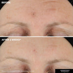 KateCeuticals firming facial moisturizer serum for deep wrinkles