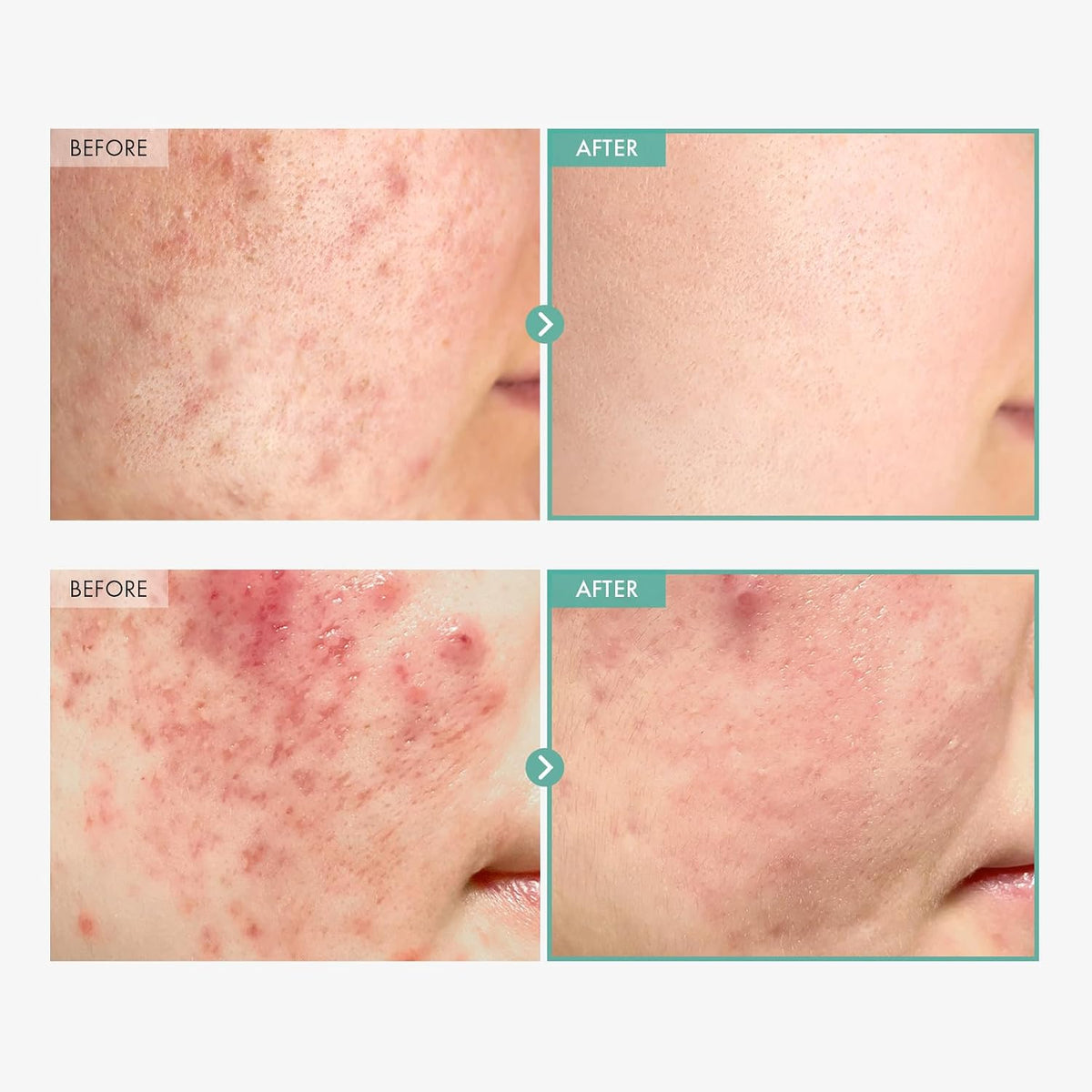 TOSOWOONG Korean skincare moisturizer tube showing product texture