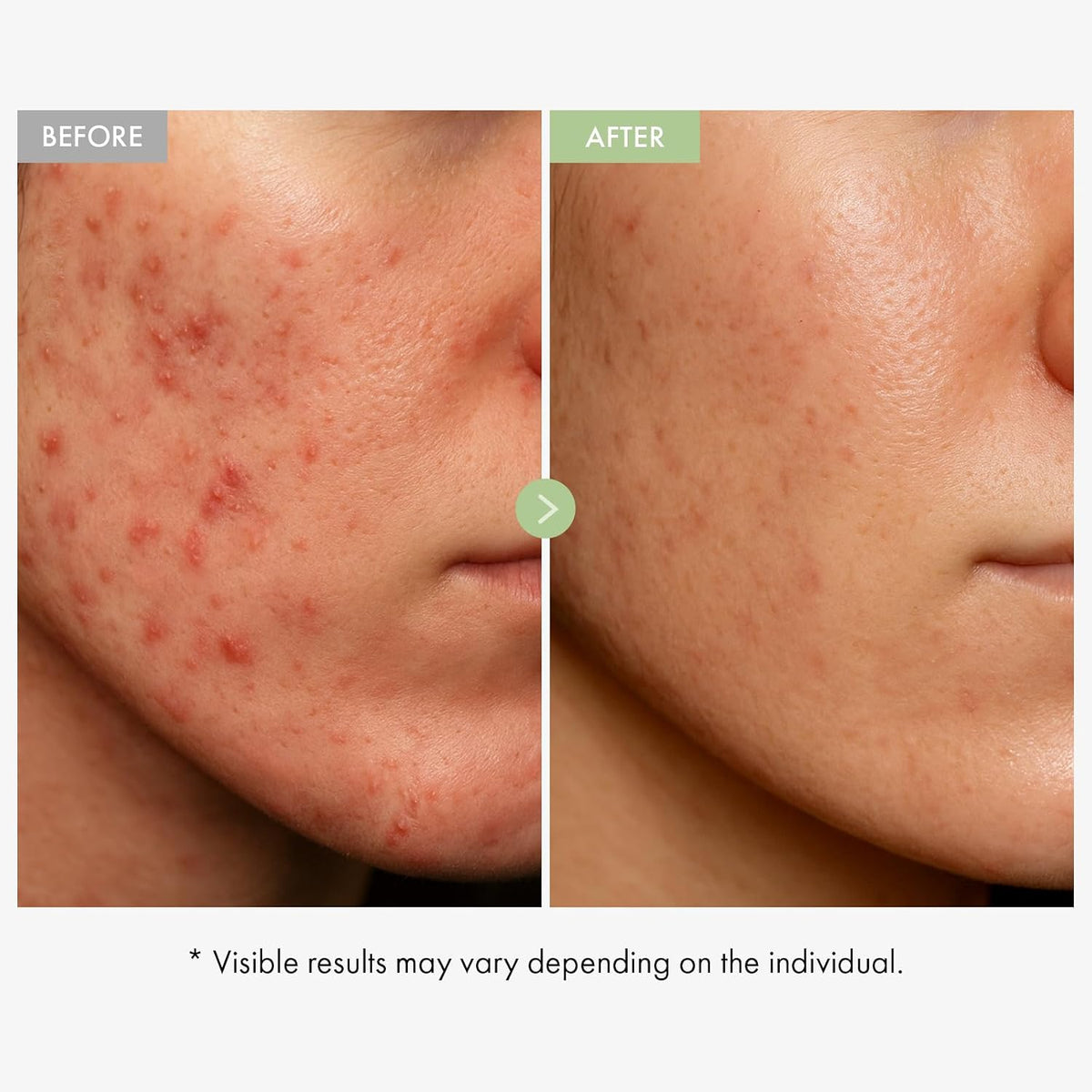 Korean skincare exosome cica face cream packaging details