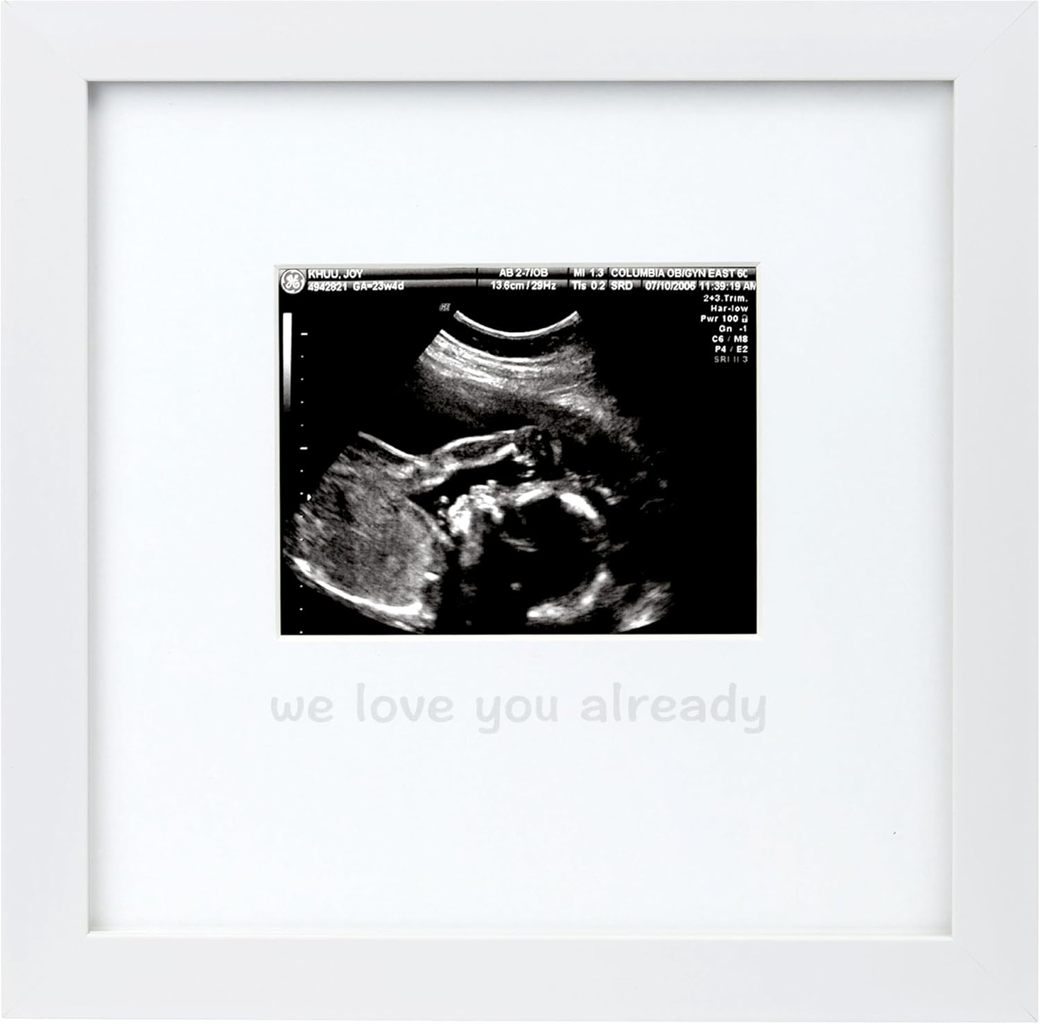 Tiny Ideas We Love You Already Sonogram Photo Frame front view white wood premium keepsake for baby ultrasound picture.