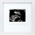 Tiny Ideas We Love You Already Sonogram Photo Frame front view white wood premium keepsake for baby ultrasound picture.