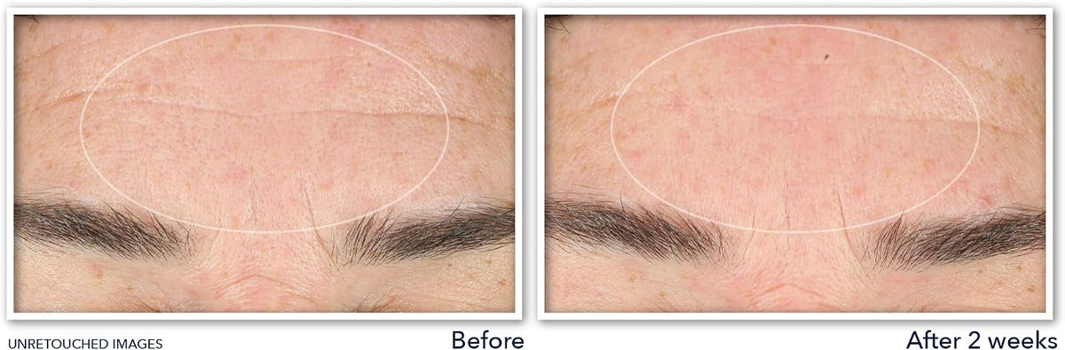 Back view of RoC Retinol Correxion face wash tube with ingredient list