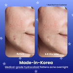 Avarelle Hydrocolloid Pimple Patches sheet showing 12 mm and 14 mm acne dots
