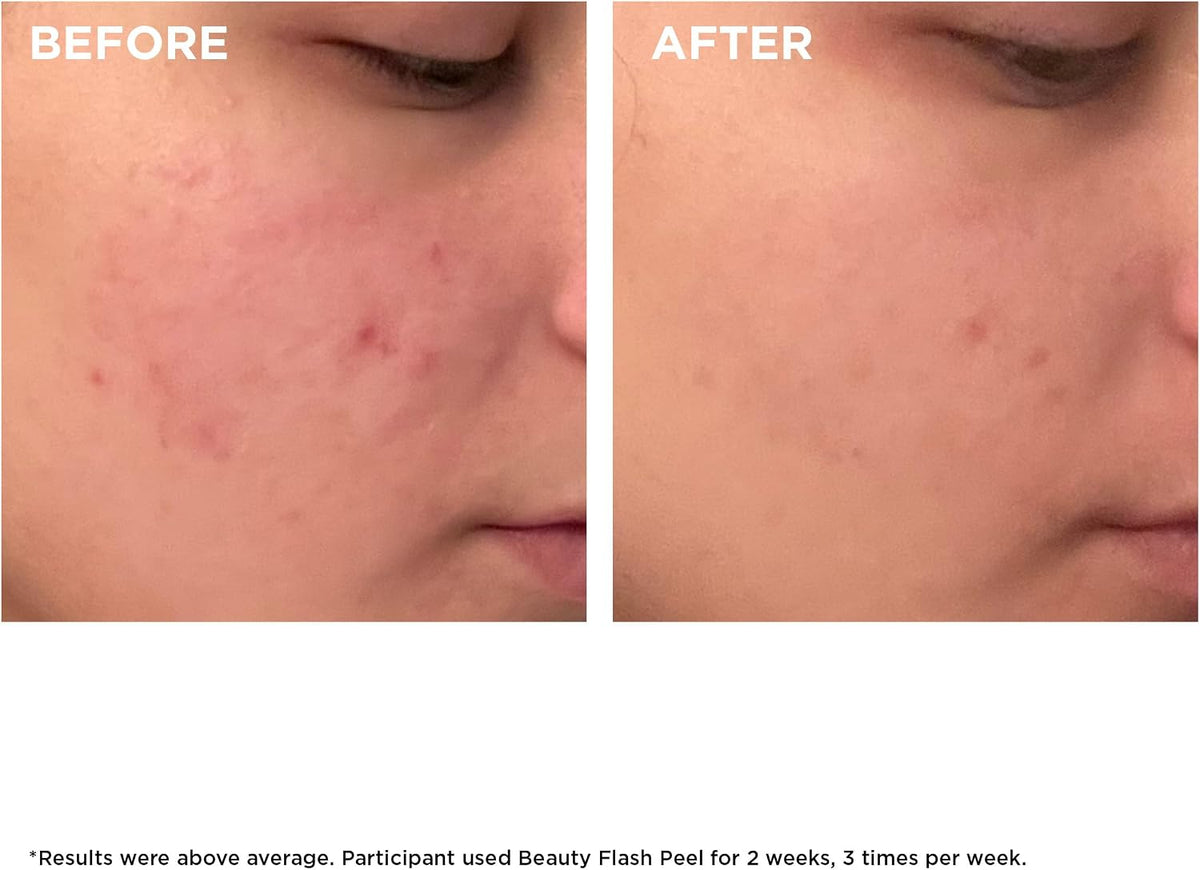 Clarins Beauty Flash Peel 50ml full set with container
